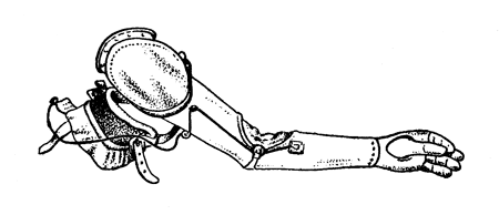 Рис. 126. Нитролаковая рука-плечо с активным большим пальцем и замком в локтевом шарнире (модель Ленинградского института протезирования).