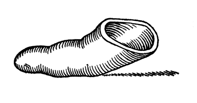 Рис. 135. Нитролаковый наконечник для удлинения фалангизированной первой пястной кости (собственное наблюдение).
