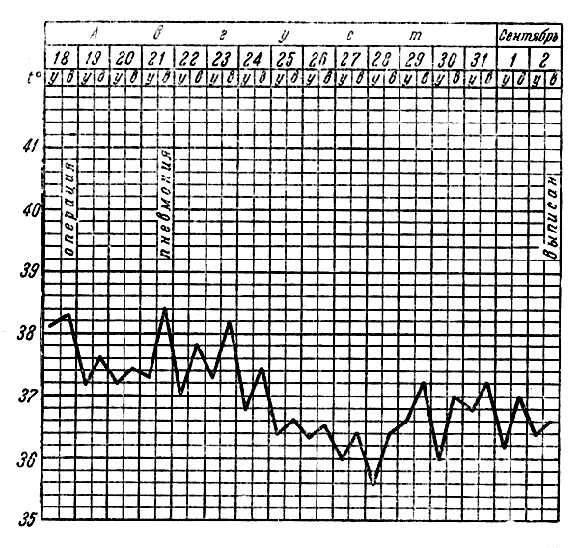 Рис. 21. Температурная кривая (случай 39). 