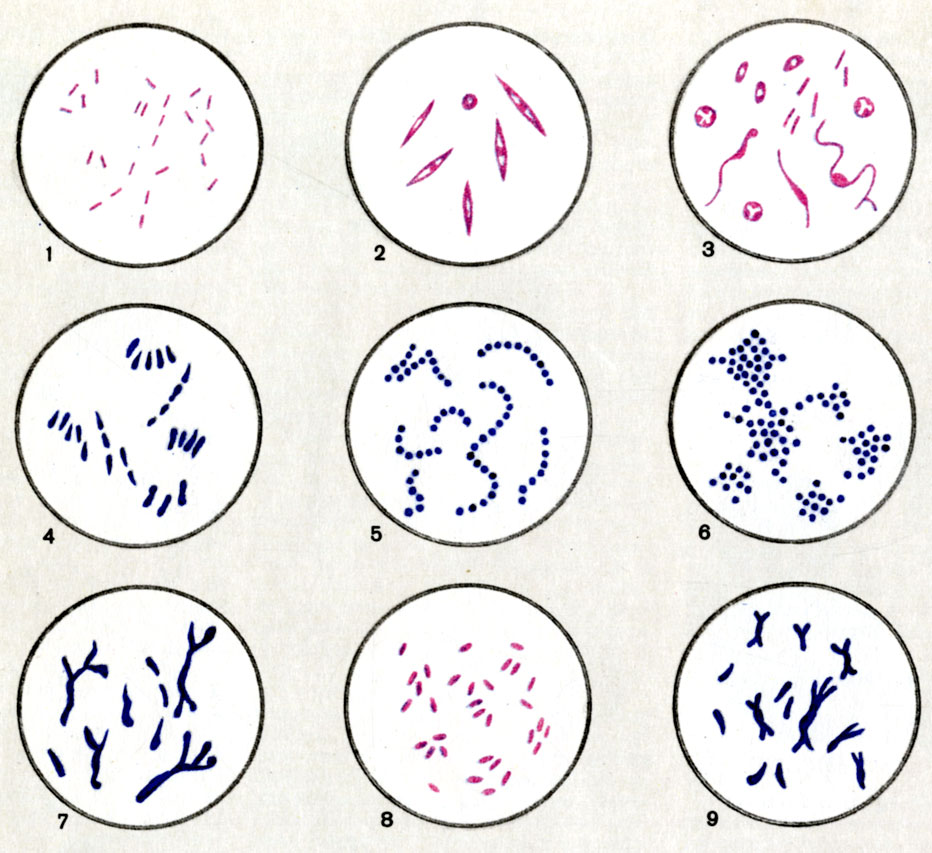    (, , ). . 1. Bacteroides. . 2. Fusobacterium. . 3. Sphaerophorus. . 4. Corynebacterium. . 5. Peptostreptococcus. . 6. Peptococcus. . 7. Actinomyses. . 8. Dilalister . 9. Lactobacillus bifermentans