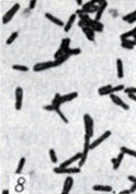 . 1-28.   Clostridium. . 8     Cl. botulinum C ( ; × 1900)