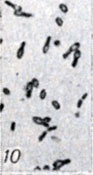 . 1-28.   Clostridium. . 10.   Cl. botulinum E (  ; × 1900)