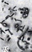 . 1-28.   Clostridium. . 15.     Cl. perfringens    ( ; × 1900)