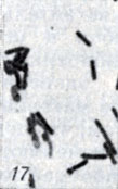 . 1-28.   Clostridium. . 17.   Cl. perfrinlgens D (  ; × 1900)