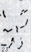 . 1-28.   Clostridium. . 23.   Cl. septicum ( ; × 1900)