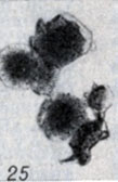 . 1-28.   Clostridium. . 25.  Cl. sordelli   (× 10)