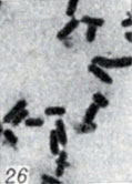 . 1-28.   Clostridium. . 26.    Cl. sordellii ( ; × 1900)