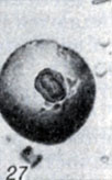 . 1-28.   Clostridium. . 27.  Cl. histolyticum    (× 64)