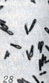 . 1-28.   Clostridium. . 28.  Cl. histolyticum  ; × 1900)