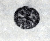 Рис. Прямая реакция дегрануляции базофилов при аллергии к пенициллину (слева - неизмененный базофил)