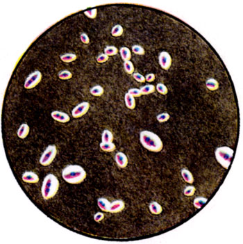 К ст. Бактерии. Рис. 3. Капсулы Klebsiella pneumoniae (окраска по Бурри)