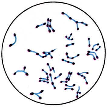 К ст. Бактерии. Рис. 4 и 5. Зерна волютина у коринебактерий