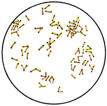 К ст. Бактерии. Рис. 4 и 5. Зерна волютина у коринебактерий