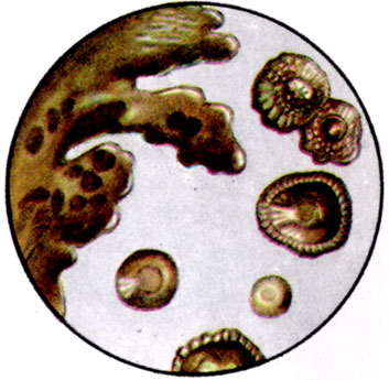 К ст. Бактерии. Рис. 9. Пигментные колонии Azotobacter chroococcum