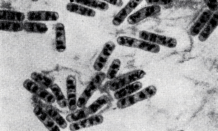 Рис. 9. Нуклеоиды Bac. eereus - темные скопления внутри клеток (окраска по Романовскому - Гимзе)