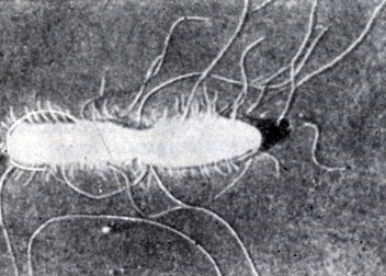 Рис. 12. Жгутики и ворсинки у S. typhi (электронограмма)