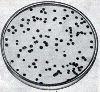 Рис. 3. Рост фага Т-2 на культуре E. coli. Видны негативные колонии фага (бляшки)