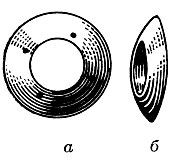 Рис. 1. Протез Балтина: а - вид спереди: вокруг отверстия видны четыре свинцовые метки; б - вид сбоку
